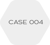 CASE004